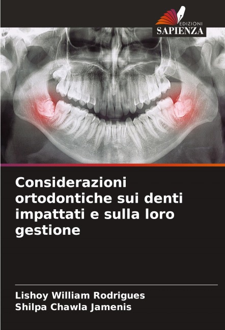Considerazioni ortodontiche sui denti impattati e sulla loro gestione - Lishoy William Rodrigues, Shilpa Chawla Jamenis