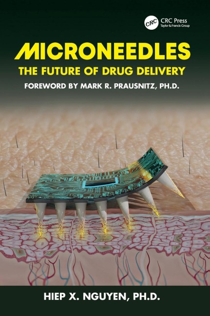 Microneedles - Hiep Xuan Nguyen