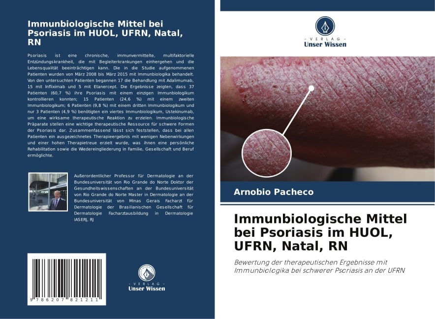 Immunbiologische Mittel bei Psoriasis im HUOL, UFRN, Natal, RN - Arnóbio Pachêco