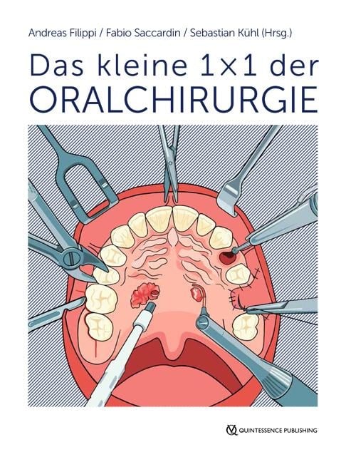 Das kleine 1 × 1 der Oralchirurgie - 