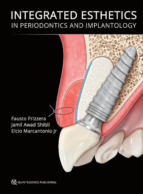 Integrated Esthetics in Periodontics and Implantology - Fausto Frizzera, Jamil Awad Shibli