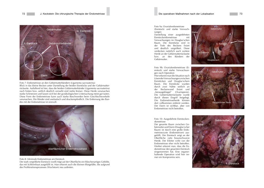 InsideView 4