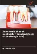 Cover-Bild zum Titel 'Znaczenie tkanek mi¿kkich w implantologii stomatologicznej' von 'Manila Jain'