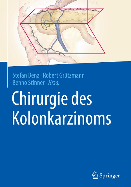 Chirurgie des Kolonkarzinoms - 