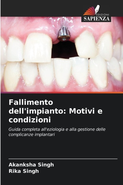 Fallimento dell'impianto: Motivi e condizioni - Akanksha Singh, Rika Singh