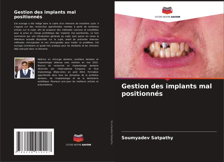 Gestion des implants mal positionnés - Soumyadev Satpathy