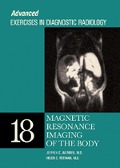 Cover-Bild zum Titel 'Magnetic Resonance Imaging of the Body' von 'Jeffrey C. Weinreb, Helen C. Redman MD'