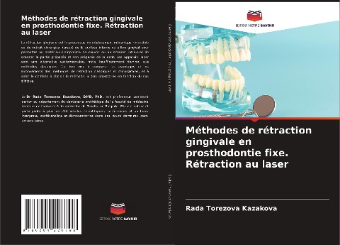 Méthodes de rétraction gingivale en prosthodontie fixe. Rétraction au laser - Rada Torezova Kazakova