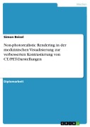 Cover-Bild zum Titel 'Non-photorealistic Rendering in der medizinischen Visualisierung zur verbesserten Kontrastierung von CT/PET-Darstellungen' von 'Simon Beisel'