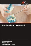 Cover-Bild zum Titel 'Impianti corticobasali' von 'Kirtika Kirtika, Reeta Jain, Gagandeep Kansal'