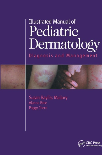 Illustrated Manual of Pediatric Dermatology - Susan Mallory, Alanna F. Bree, Peggy Chern