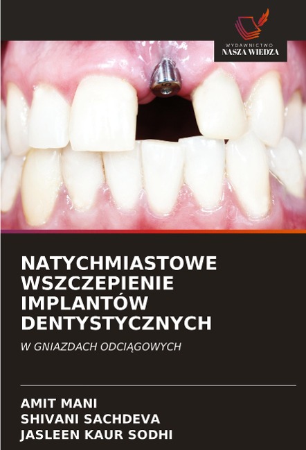 NATYCHMIASTOWE WSZCZEPIENIE IMPLANTÓW DENTYSTYCZNYCH - Amit Mani, Shivani Sachdeva, Jasleen Kaur Sodhi