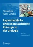 Laparoskopische und roboterassistierte Chirurgie in der Urologie - 