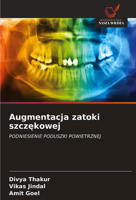 Augmentacja zatoki szcz¿kowej - Divya Thakur, Vikas Jindal, Amit Goel