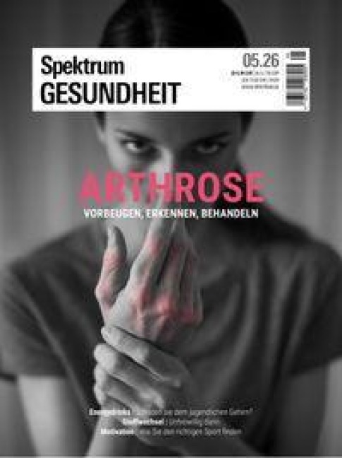 Spektrum Gesundheit 5/2026 - Arthrose - 