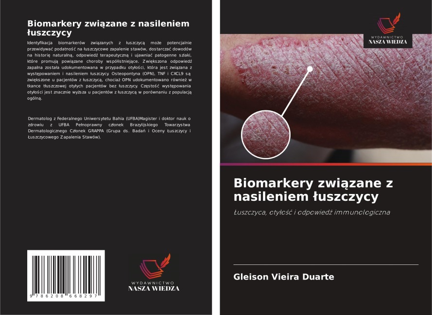 Biomarkery zwi¿zane z nasileniem ¿uszczycy - Gleison Vieira Duarte