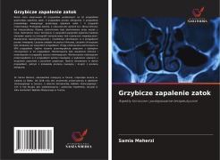 Cover-Bild zum Titel 'Grzybicze zapalenie zatok' von 'Samia Meherzi'