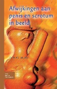 Cover-Bild zum Titel 'Afwijkingen Aan Penis En Scrotum in Beeld' von 'H H J Leliefeld'