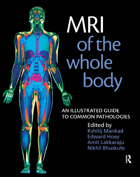 MRI of the Whole Body - Nikhil Bhuskute, Kshitij Mankad, Amit Lakkaraju, Edward Hoey