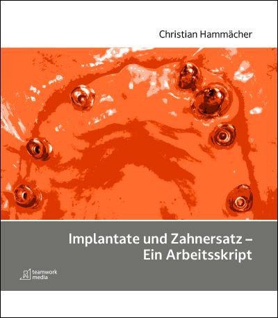 Implantate und Zahnersatz - Ein Arbeitsskript - Christian Hammächer