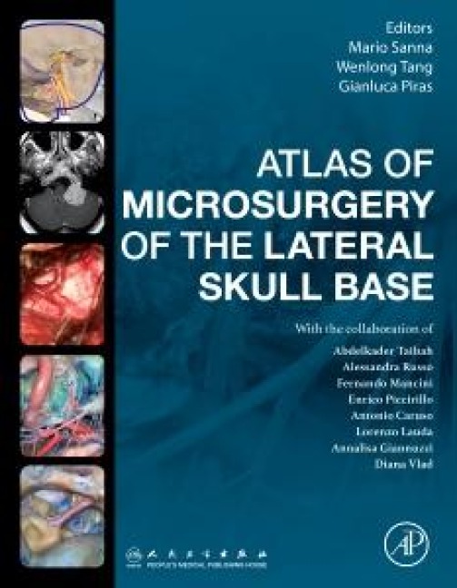 Atlas of Microsurgery of the Lateral Skull Base - Mario Sanna, Gianluca Piras, Wenlong Tang, Abdelkader Taibah, Alessandra Russo