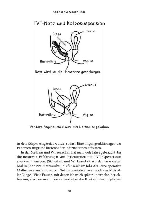 InsideView 2