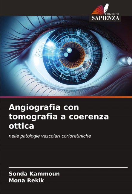Angiografia con tomografia a coerenza ottica - Sonda Kammoun, Mona Rekik