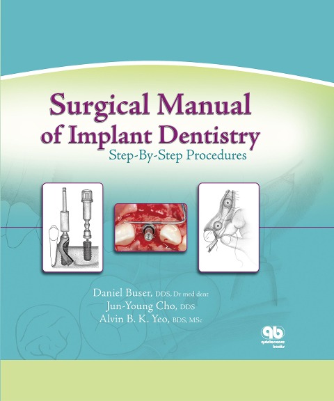 Surgical Manual of Implant Dentistry - Daniel Buser, Jun-Young Cho, Alvin B. Yeo