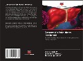 Cover-Bild zum Titel 'Cancer du foie dans l'enfance' von 'Jean Litardo P., Estefanía Correa C., Abraham Jurado R.'