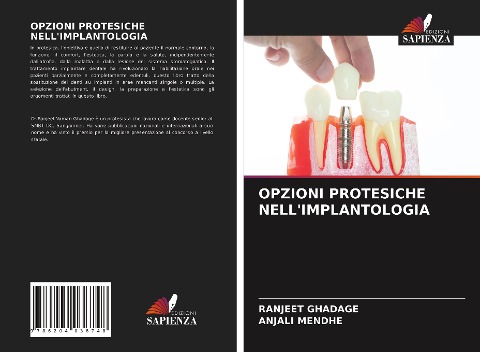 OPZIONI PROTESICHE NELL'IMPLANTOLOGIA - Ranjeet Ghadage, Anjali Mendhe