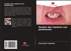 Cover-Bild zum Titel 'Gestion des implants mal positionnés' von 'Soumyadev Satpathy'