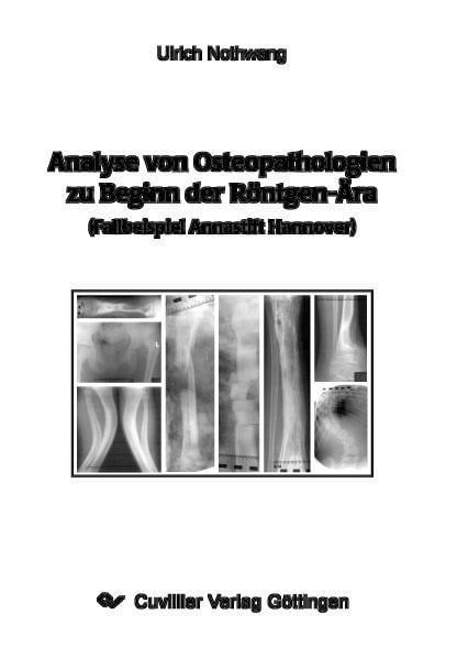 Analyse von Osteopathologien zu Beginn der Röntgen-Ära (Fallbeispiel Annastift Hannover) - 