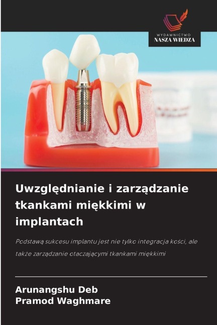 Uwzgl¿dnianie i zarz¿dzanie tkankami mi¿kkimi w implantach - Arunangshu Deb, Pramod Waghmare