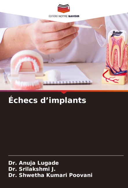 Échecs d'implants - Anuja Lugade, Srilakshmi J., Shwetha Kumari Poovani