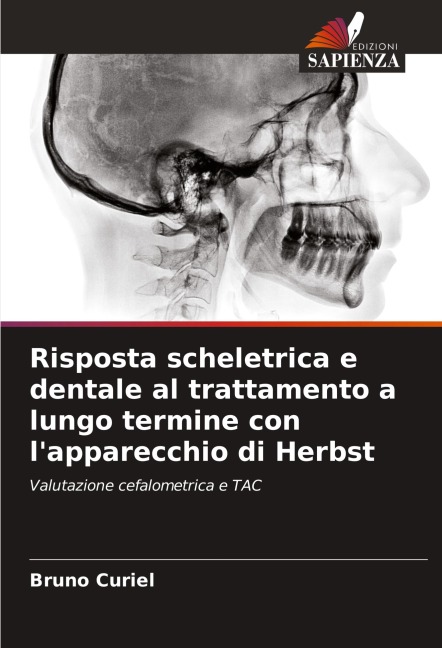 Risposta scheletrica e dentale al trattamento a lungo termine con l'apparecchio di Herbst - Bruno Curiel