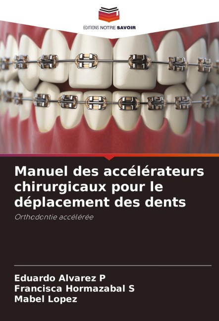Manuel des accélérateurs chirurgicaux pour le déplacement des dents - Eduardo Alvarez P, Francisca Hormazabal S, Mabel Lopez
