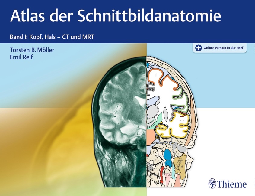 Atlas der Schnittbildanatomie - Torsten Bert Möller, Emil Reif
