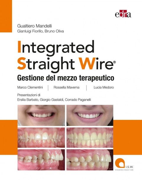 Integrated straight wire. Gestione del mezzo terapeutico - 