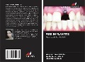 Cover-Bild zum Titel 'PERI IMPLANTITE' von 'Navneet Kour Mehta, Nadia Irshad Wani, Hilal Ahmad Hela'
