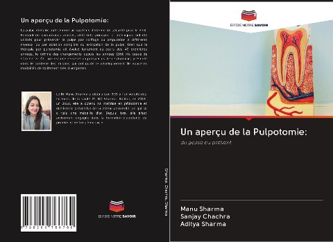 Un aperçu de la Pulpotomie: - Manu Sharma, Sanjay Chachra, Aditya Sharma