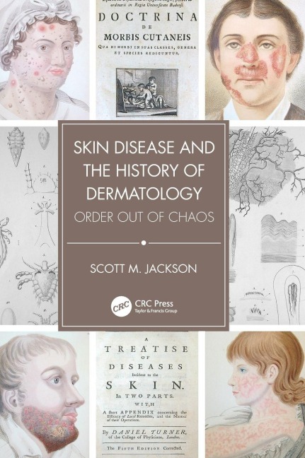 Skin Disease and the History of Dermatology - Scott Jackson