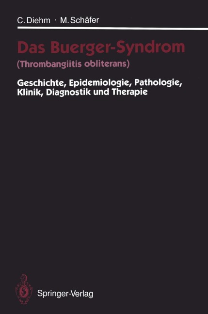 Das Buerger-Syndrom (Thrombangiitis obliterans) - Michael Schäfer, Curt Diehm