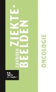 Cover-Bild zum Titel 'Zakboek Ziektebeelden Oncologie' von 'Karin Linden'