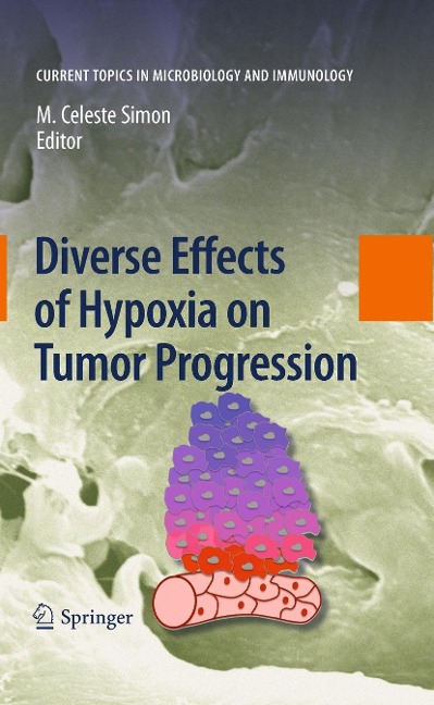Diverse Effects of Hypoxia on Tumor Progression - 
