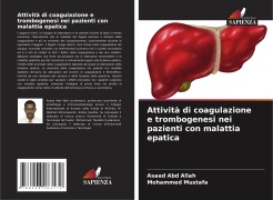 Cover-Bild zum Titel 'Attività di coagulazione e trombogenesi nei pazienti con malattia epatica' von 'Asaad Abd Allah, Mohammed Mustafa'