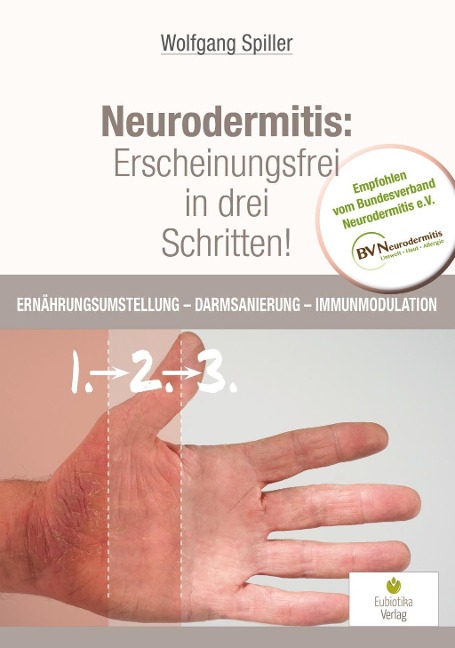 Neurodermitis: Erscheinungsfrei in drei Schritten! - Spiller Wolfgang