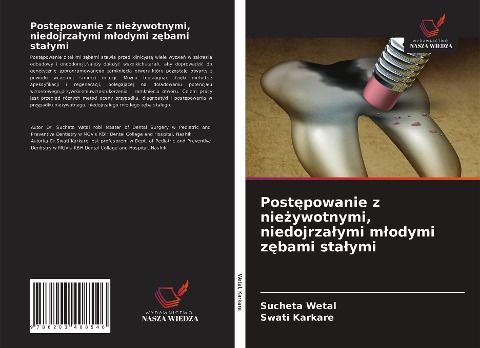 Post¿powanie z nie¿ywotnymi, niedojrza¿ymi m¿odymi z¿bami sta¿ymi - Sucheta Wetal, Swati Karkare