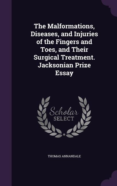The Malformations, Diseases, and Injuries of the Fingers and Toes, and Their Surgical Treatment. Jacksonian Prize Essay - Thomas Annandale