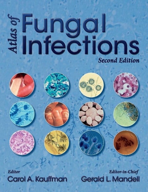 Atlas of Fungal Infections - 