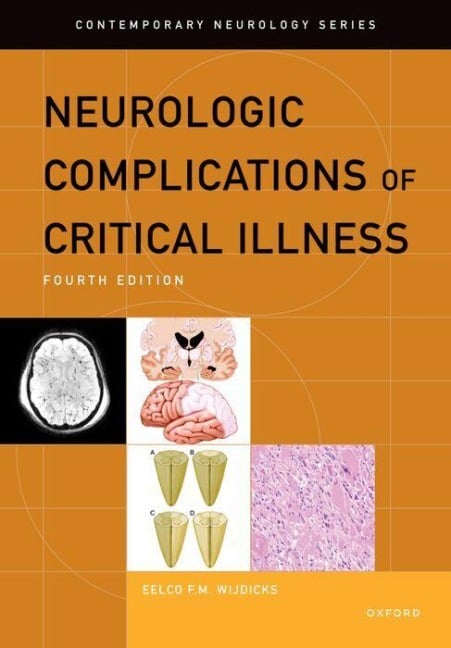 Neurologic Complications of Critical Illness - Eelco F M Wijdicks